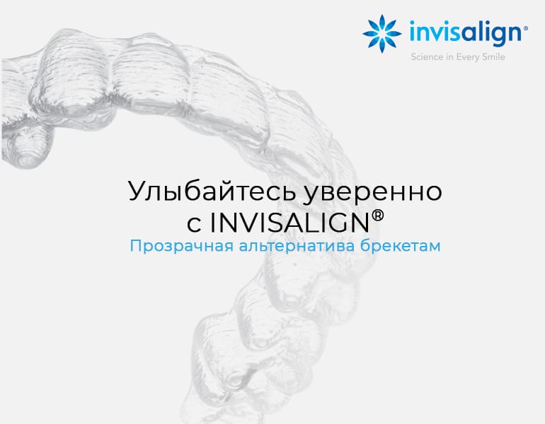 Альтернатива брекетам